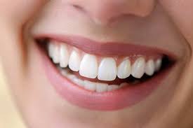 Get Your Beautiful Smile Back Fast with All On 4 Dental Implant