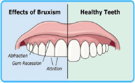 Healthy Teeth